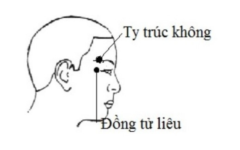 Huyệt Ty Trúc Không