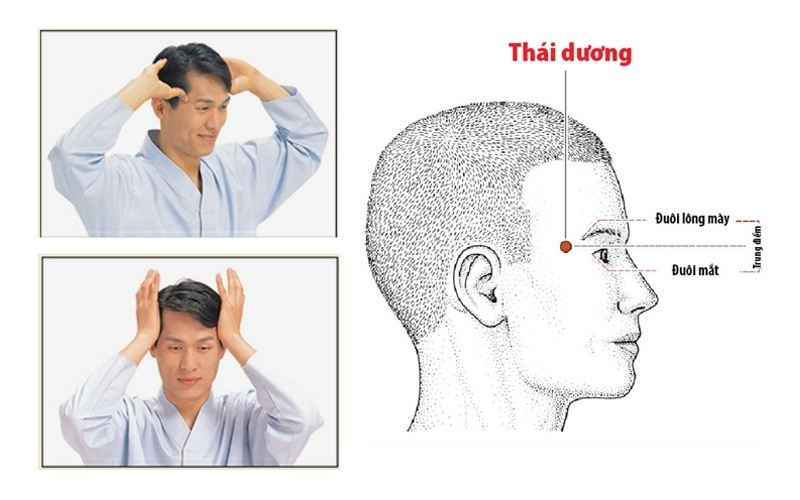 Huyệt Thái Dương