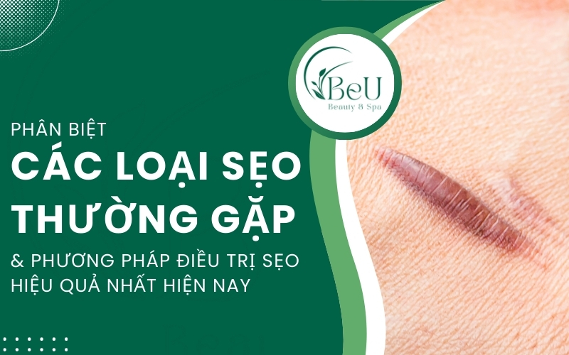 các loại sẹo