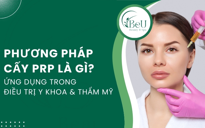 phương pháp cấy prp