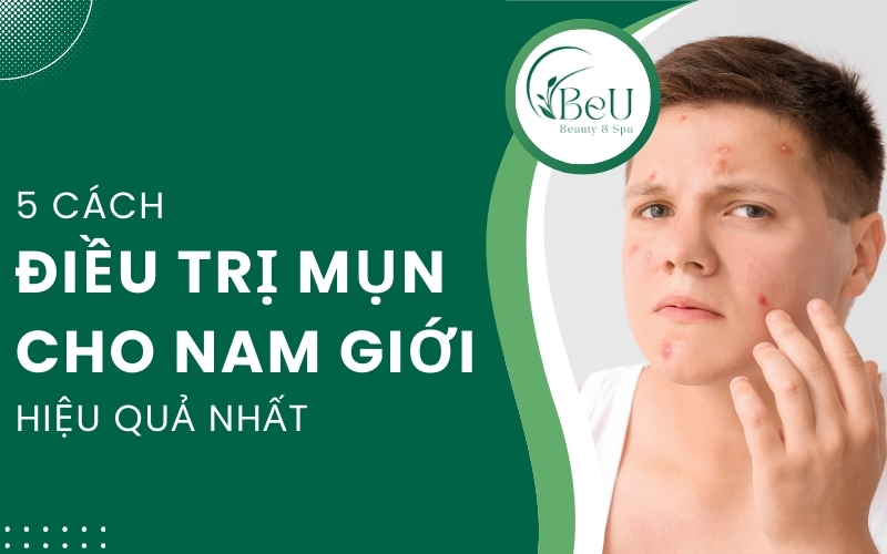 trị mụn cho nam