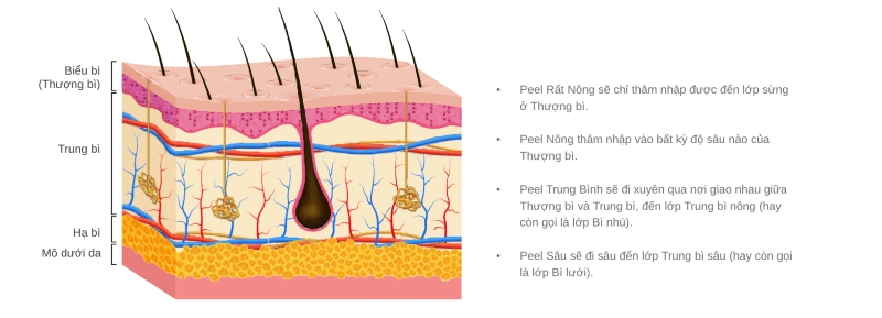 Các cấp độ peel da