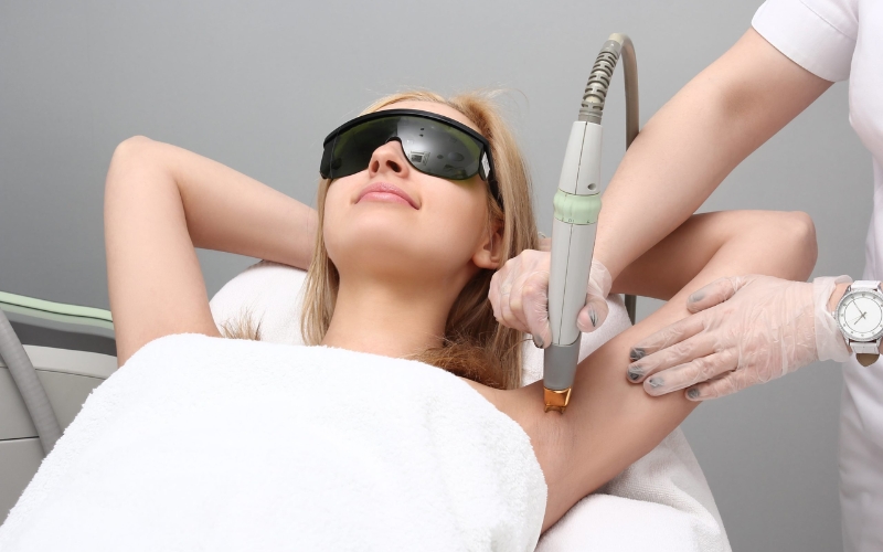 Công nghệ laser điều trị thẩm mỹ vùng nách