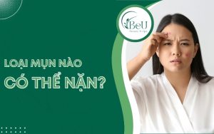 Mụn Nào Có Thể Nặn