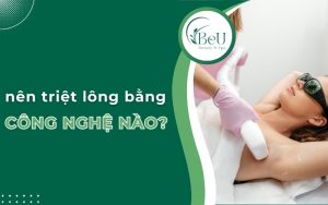 nên triệt lông bằng công nghệ nào