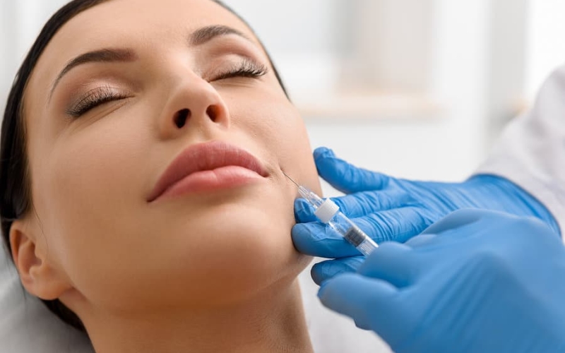 nhược điểm của tiêm filler rãnh cười