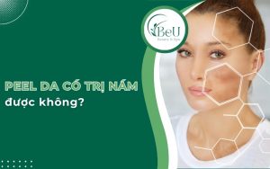 peel da có trị nám được không