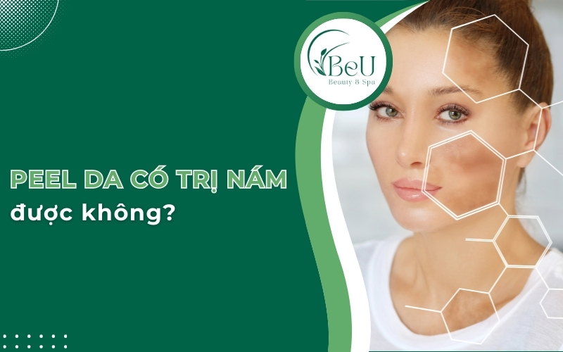 peel da có trị nám được không