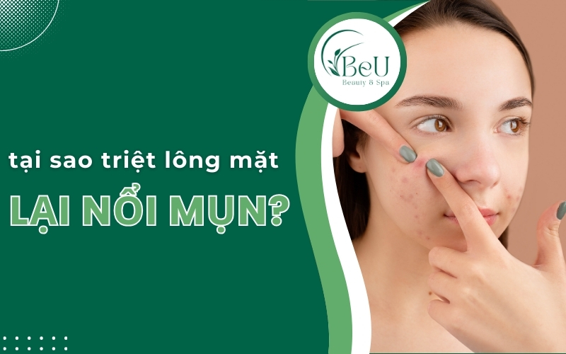 tại sao triệt lông mặt lại nổi mụn