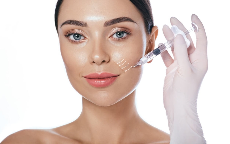 Tiêm filler rãnh cười có hiệu quả không