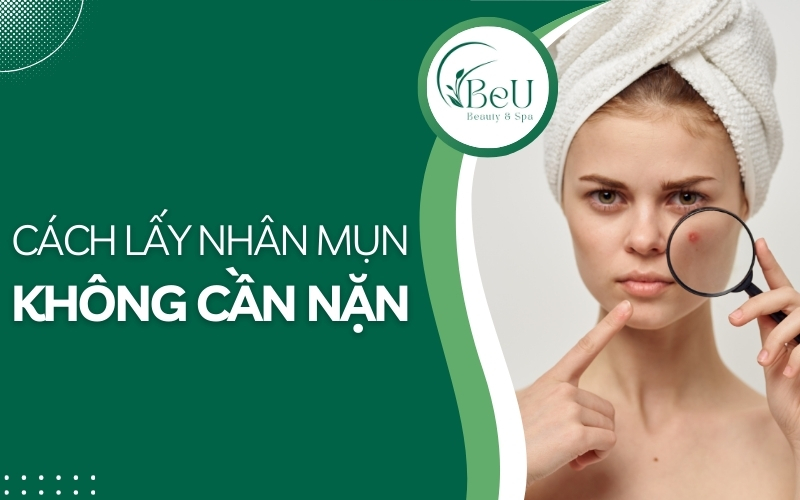 cách lấy nhân mụn không cần nặn