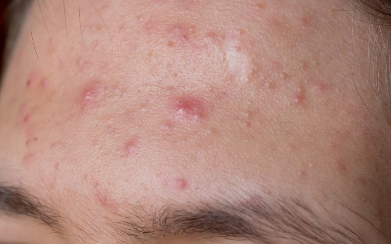 Một số nguyên nhân phổ biến khác