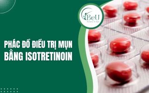 phác đồ điều trị mụn bằng Isotretinoin