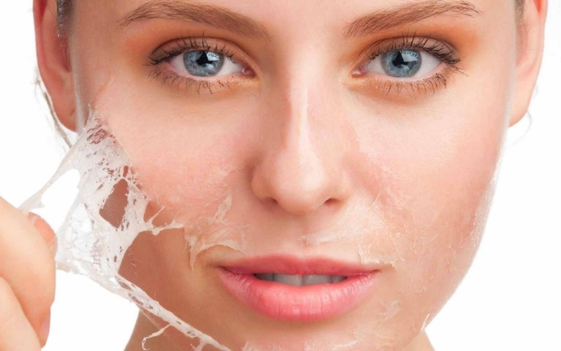 Cơ chế hoạt động của peel da