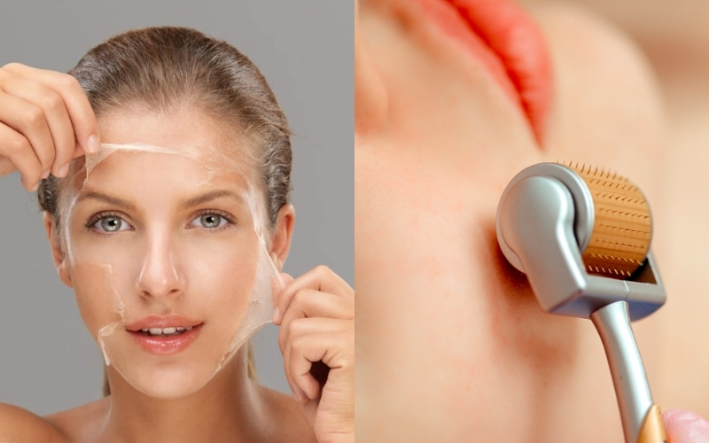 Điểm giống nhau giữa lăn kim và peel da
