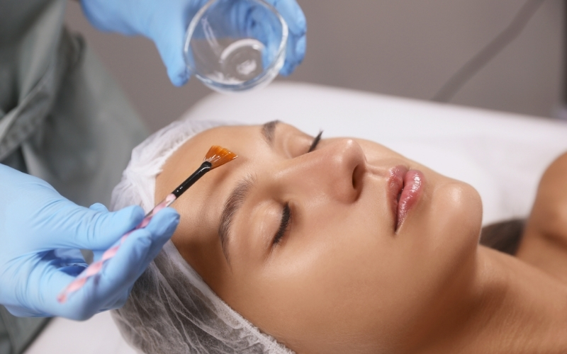Ưu - Nhược điểm của peel da