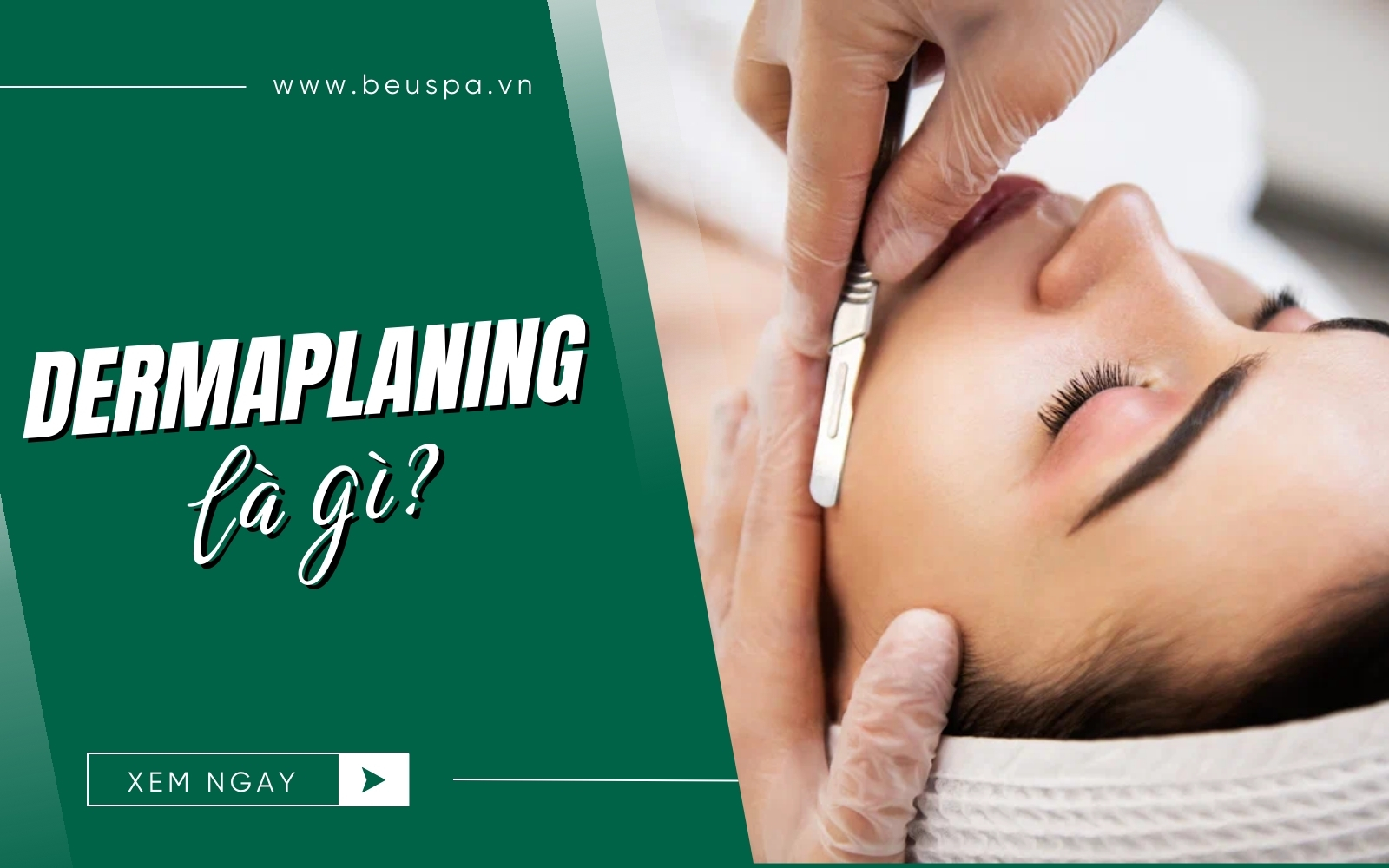 Dermaplaning là gì