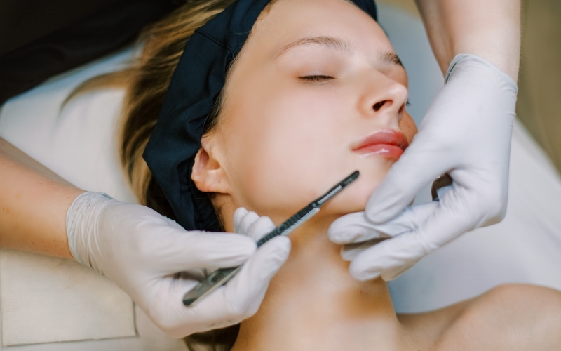 Làm Dermaplaning có khiến lông mọc dày và sẫm màu hơn không