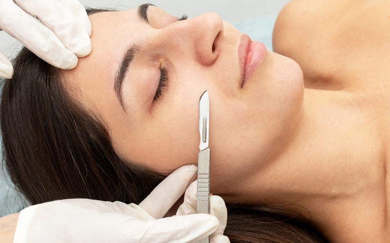 Một số lưu ý cần nhớ khi thực hiện Dermaplaning