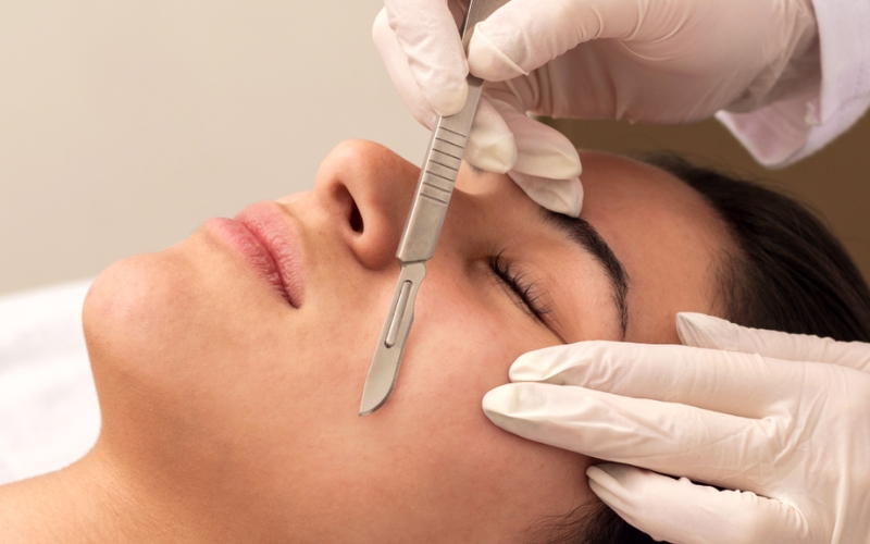 Nhược điểm của Dermaplaning