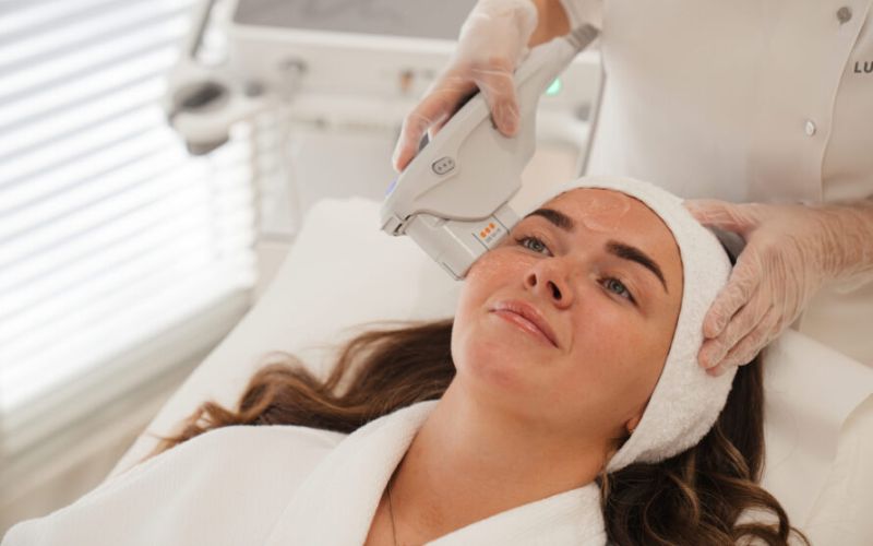 Hiệu quả của Ultherapy Prime giữ được bao lâu