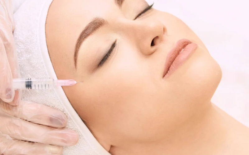 Nguyên nhân tiêm filler thái dương bị đau đầu