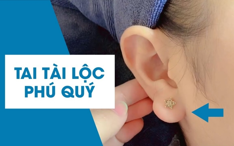 Tiêm tai tài lộc có tác dụng gì